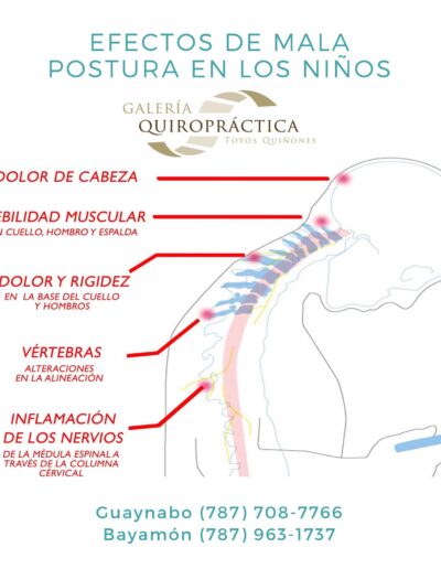 efectos de la mala postura en niños